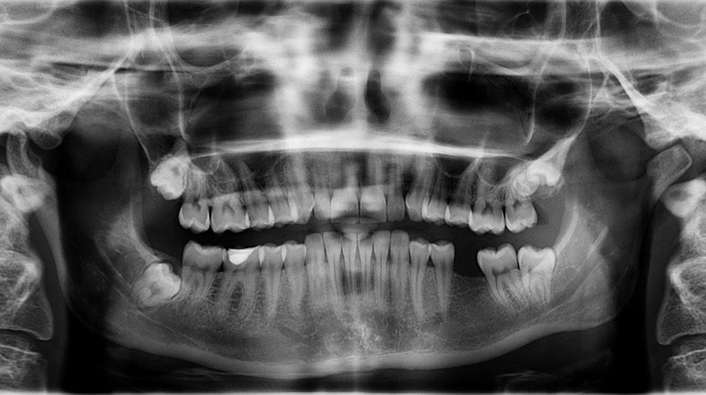 x ray 961977 1280 1024x573 - La Messe du Chaos « B »